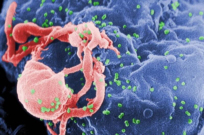 Подробнее о "Жительница Аргентины полностью избавилась от ВИЧ без лечения"