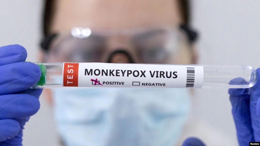 Подробнее о "Власти США объявили чрезвычайную ситуацию в области здравоохранения из-за оспы обезьян"